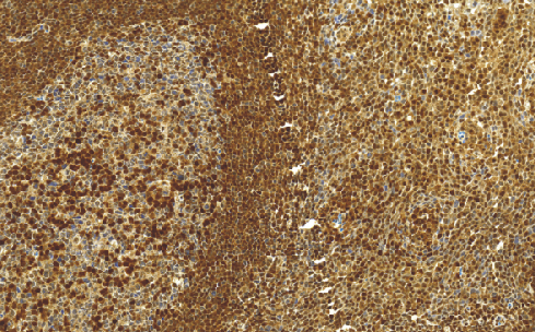 鼠抗人p27单克隆抗体 TDCPM-0120