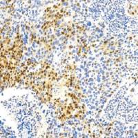 鼠抗人p21（WAF1蛋白）单克隆抗体  TDCPM-0111