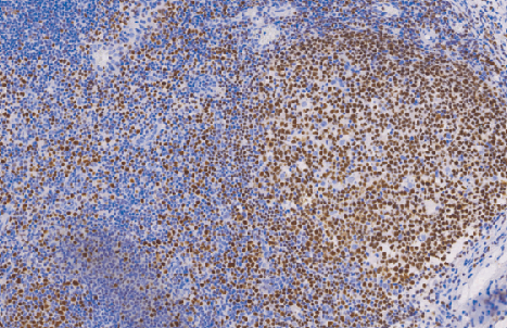 鼠抗人八聚体结合转录因子2单克隆抗体 TDCOM-0011