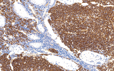 鼠抗人巢蛋白单克隆抗体 TDCNM-0030