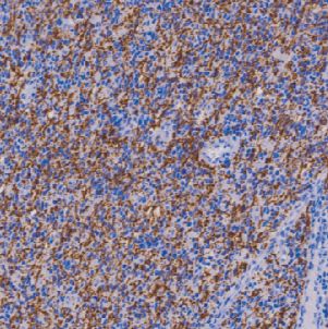 鼠抗人髓鞘碱性蛋白单克隆抗体  TDCMM-0320