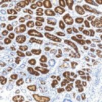 鼠抗人粘液素糖蛋白5AC单克隆抗体  TDCMM-0281