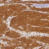 鼠抗人广谱肌动蛋白单克隆抗体  TDCMM-0310