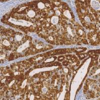 鼠抗人P16单克隆抗体  TDCPM-0103