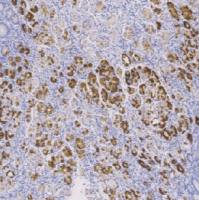 鼠抗人粘液素糖蛋白6 单克隆抗体  TDCMM-0290