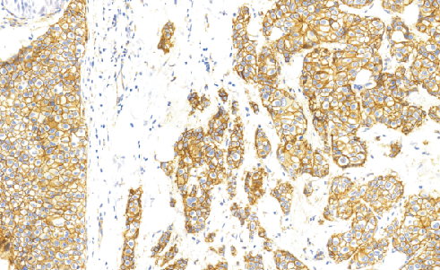 兔抗人p120单克隆抗体  TDCPR-0181