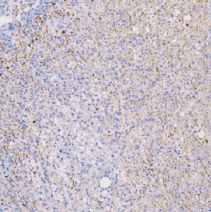 鼠抗人神经丝蛋白抗体单克隆抗体  TDCNM-0041