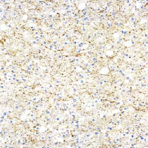 鼠抗人神经丝蛋白抗体单克隆抗体  TDCNM-0050