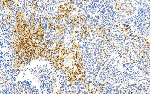 鼠抗人p21（WAF1蛋白）单克隆抗体  TDCPM-011