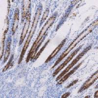 鼠抗人粘液素糖蛋白2单克隆抗体  TDCMM-0261