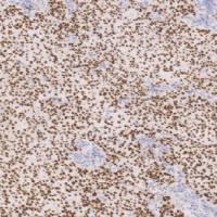 鼠抗人P40单克隆抗体 TDCPM-0133