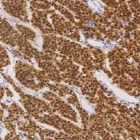 鼠抗人OCT3/4单克隆抗体  TDCOM-0061