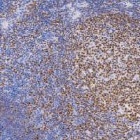 鼠抗人八聚体结合转录因子2单克隆抗体 TDCOM-0011