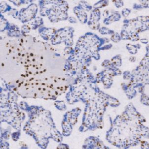 鼠抗人p57蛋白单克隆抗体  TDCPM-0151