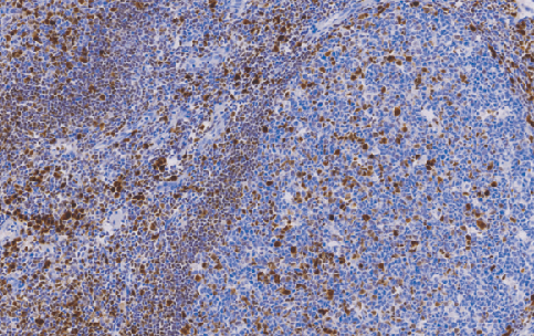 兔抗人多发性骨髓瘤癌基因(MUM-1)单克隆抗体 TDCM