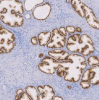 兔抗人NKX3.1单克隆抗体  TDCNR-0060