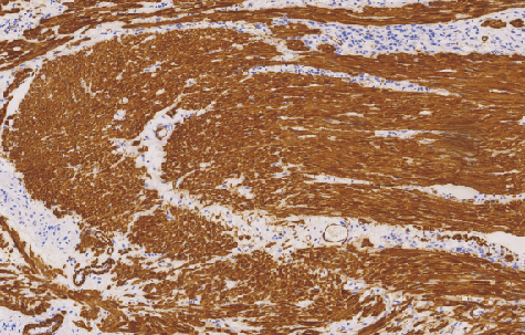 鼠抗人广谱肌动蛋白单克隆抗体  TDCMM-0310