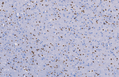 兔抗人少突胶质细胞转录因子2单克隆抗体 TDCOR-003