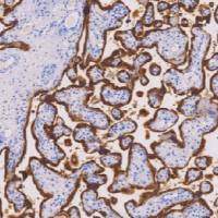 兔抗人胎盘催乳素多克隆抗体