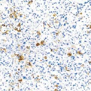 鼠抗人甲状腺刺激激素单克隆抗体  TDCTM-0213