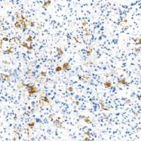 鼠抗人甲状腺刺激激素单克隆抗体  TDCTM-0213