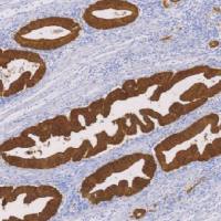 鼠抗人绒毛蛋白单克隆抗体  TDCVM-0031