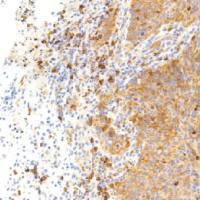 兔抗人生长激素抑制素单克隆抗体  TDCSR-0160