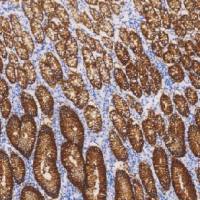 鼠抗人Claudin 18.2单克隆抗体  TDCCM-1270