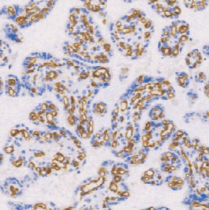 兔抗人血管内皮生长因子单克隆抗体  TDCVR-0011