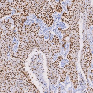 兔抗人神经（管）嵴转录因子2单克隆抗体  TDCSR-0171