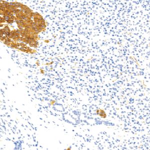 鼠抗人突触素单克隆抗体  TDCSM-0250