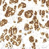 鼠抗人Pax-8单克隆抗体  TDCPM-0252