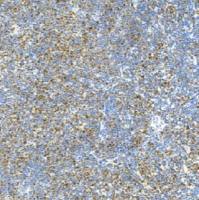 鼠抗人神经（管）嵴转录因子11单克隆抗体  TDCSM-0190