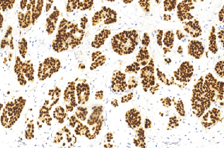 鼠抗人Pax-8单克隆抗体 TDCPM-0252