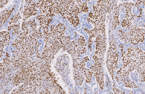 兔抗人神经(管)嵴转录因子2单克隆抗体 TDCSR-017