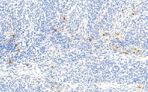 鼠抗人类胰蛋白酶单克隆抗体  TDCTM-0200