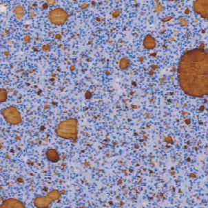 鼠抗人甲状腺球蛋白单克隆抗体  TDCTM-0150