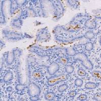 兔抗人幽门螺旋杆菌多克隆抗体