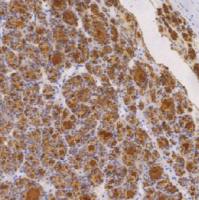 鼠抗人甲状腺球蛋白单克隆抗体  TDCTM-0152