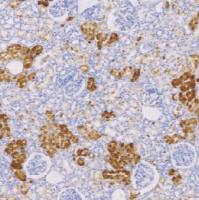 兔抗人S100A1单克隆抗体  TDCSR-0110