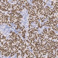 鼠抗人SALL4单克隆抗体  TDCSM-0130