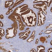 鼠抗人前列腺特异性抗原单克隆抗体  TDCPM-0404