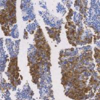 兔抗人促黄体生成激素多克隆抗体