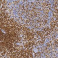 兔抗人CD4单克隆抗体 TDCCR-0343