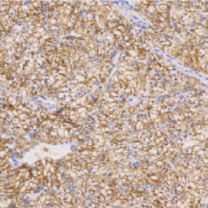 兔抗人钙视网膜蛋白多克隆抗体