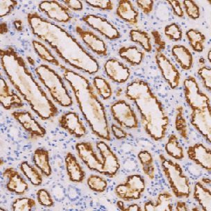 鼠抗人肾细胞癌标记物单克隆抗体  TDCRM-0021