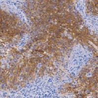 兔抗人Glut1多克隆抗体