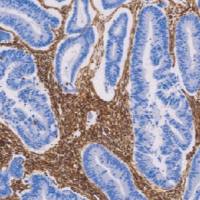 鼠抗人波形蛋白单克隆抗体 TDCVM-0040