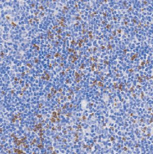 鼠抗人T细胞胞浆内抗原单克隆抗体  TDCTM-0220