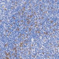 鼠抗人T细胞胞浆内抗原单克隆抗体  TDCTM-0220